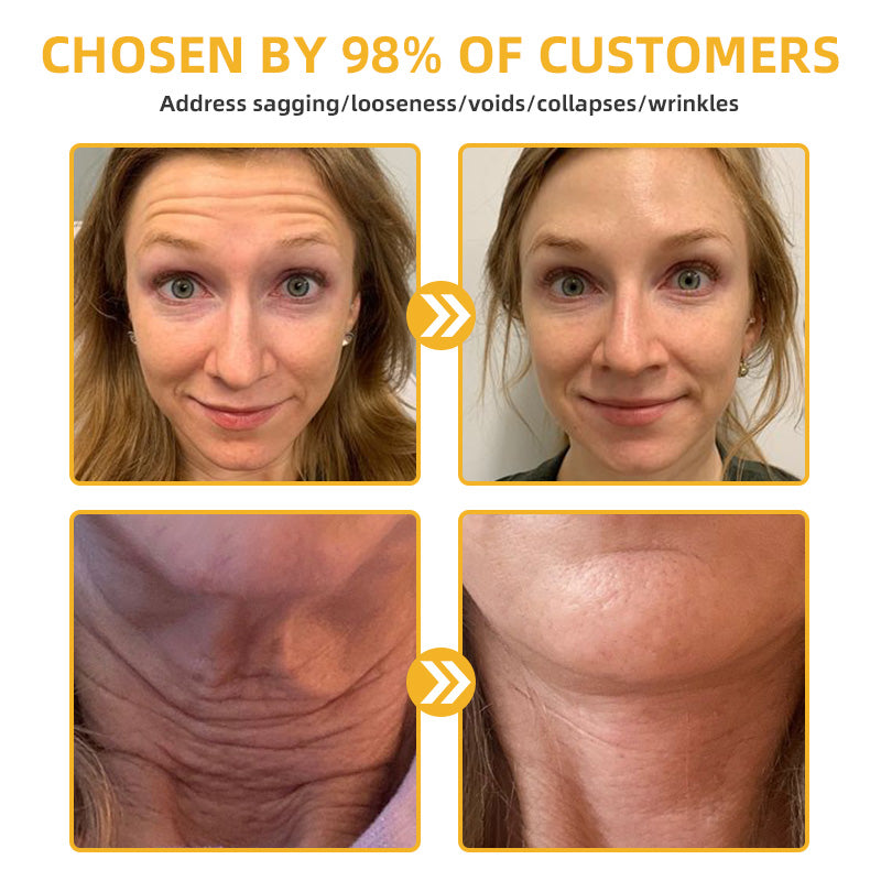 Bee Venom Retinol Skin Salve Ointment 🐝𝐀𝐀𝐃 𝐑𝐄𝐂𝐎𝐌𝐌𝐄𝐍𝐃𝐒(🔥55% Off for a Limited Time!)