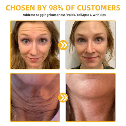 Bee Venom Retinol Skin Salve Ointment 🐝𝐀𝐀𝐃 𝐑𝐄𝐂𝐎𝐌𝐌𝐄𝐍𝐃𝐒(🔥55% Off for a Limited Time!)