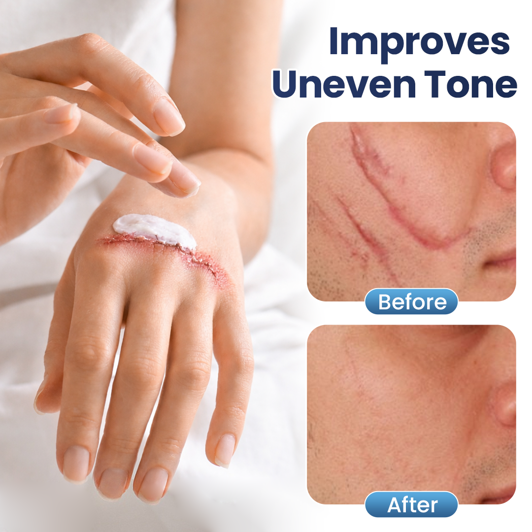 Healrize® Der-maFix Texture Repair Gel ✨